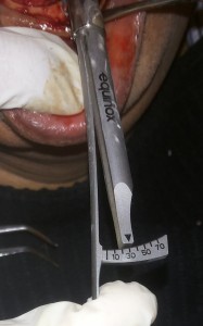 TORQUE RATCHET USE   